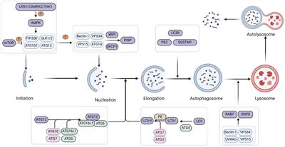 The pivotal role of dysregulated autophagy in the progression of non-alcoholic fatty liver disease